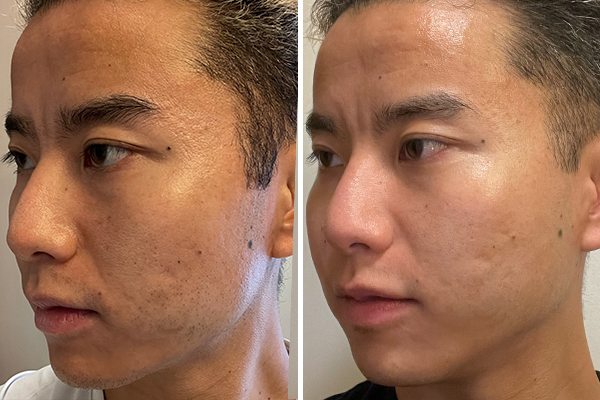 before-after Images