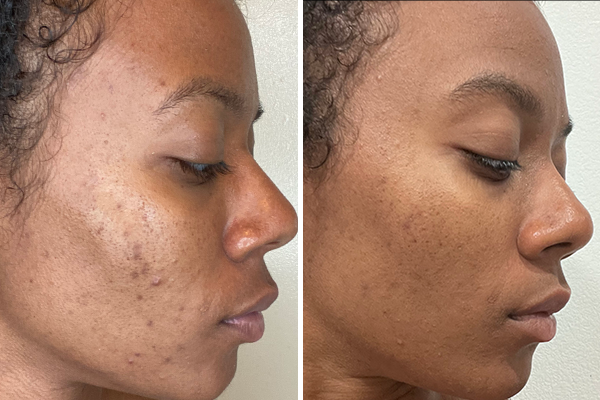 before-after Images