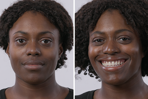 before-after Images