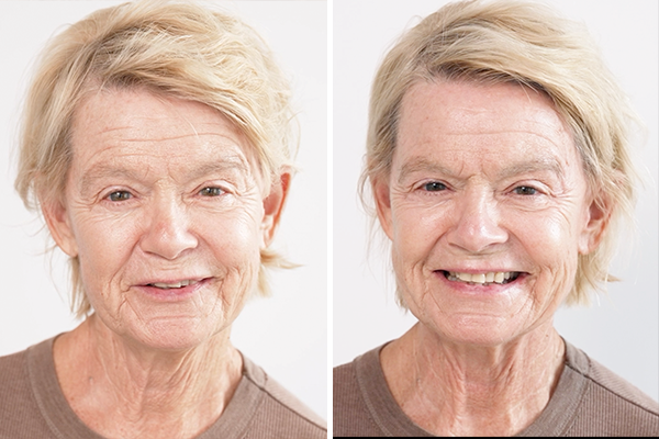 before-after Images