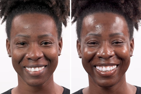 before-after Images