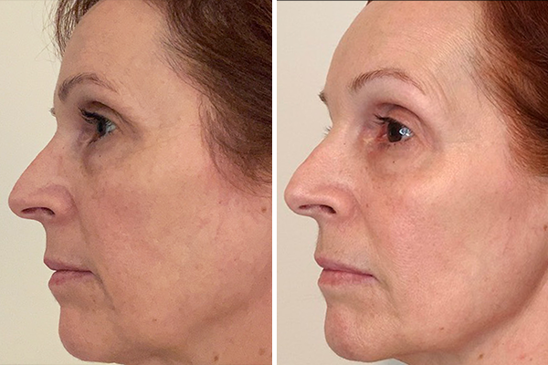 before-after Images