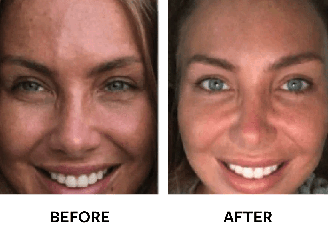 before after review result image hanacure